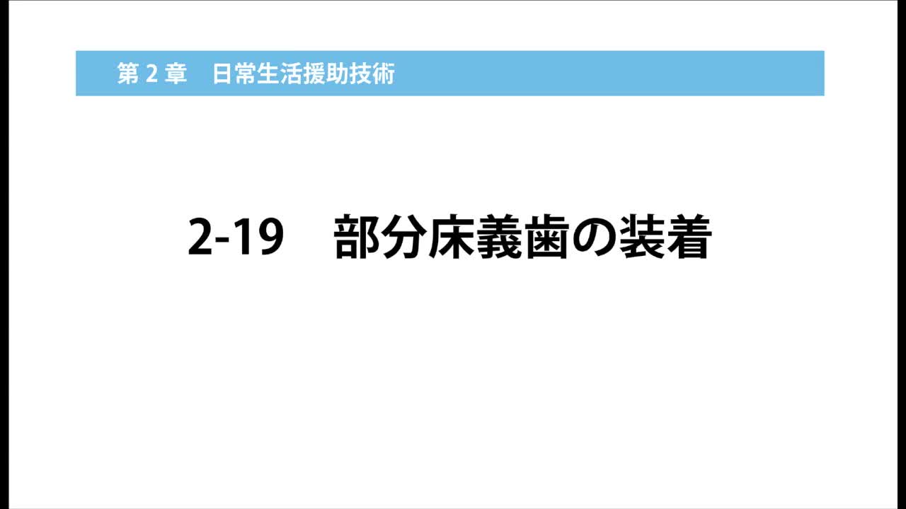 2–19  部分床義歯の装着